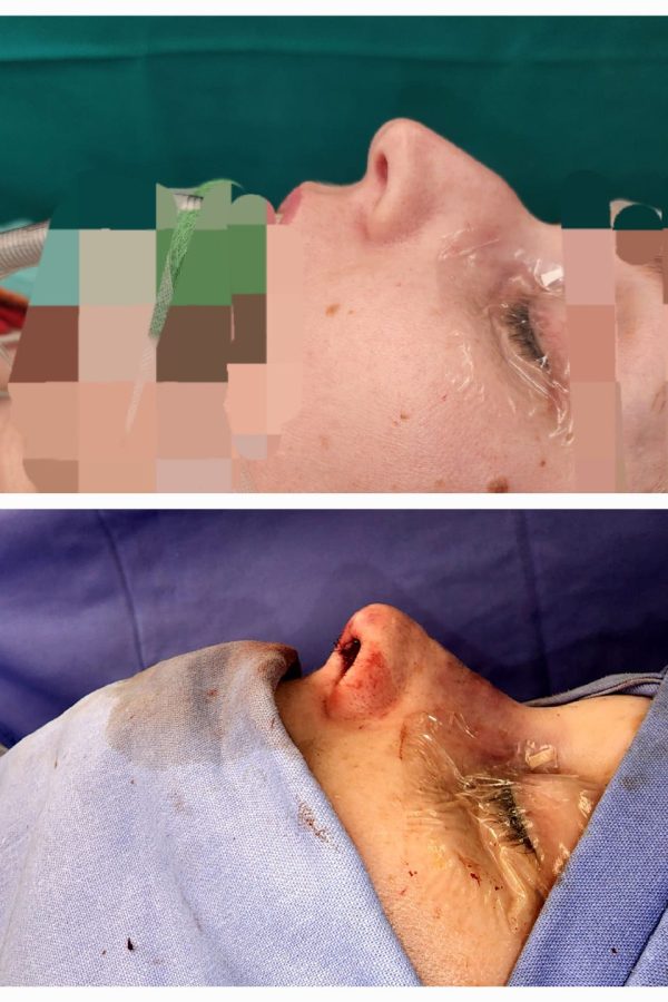 rhinoplastic surgeon johannesburg
